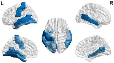 Neuro-Behavioral Correlates of Executive Dysfunctions in Dyslexia Over Development From Childhood to Adulthood